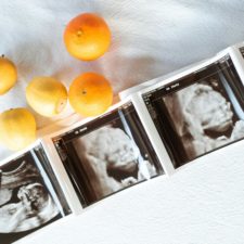 Ein Ultraschall Bild eines Embryos - das werdende Baby!